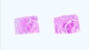 Paraffin Tissue Section - Human Adult Normal: Brain: Corpus Callosum