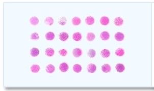 Frozen Tissue Array - 40 Different Lung Tumors and 5 Corresponding Normal Controls